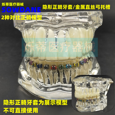 海烁正畸模型包邮隐形牙套