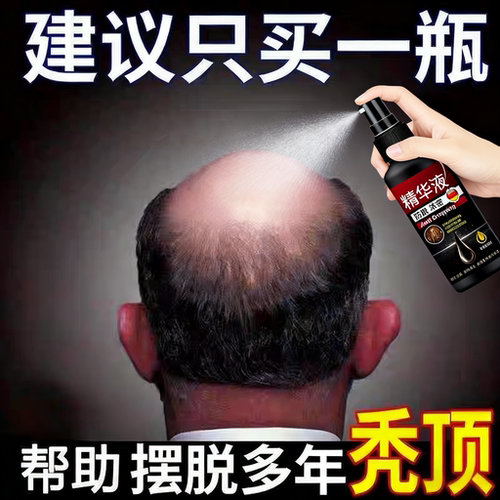 【欧美爆款】生发液育发液防脱增发密发固发发际线快速增长精华液