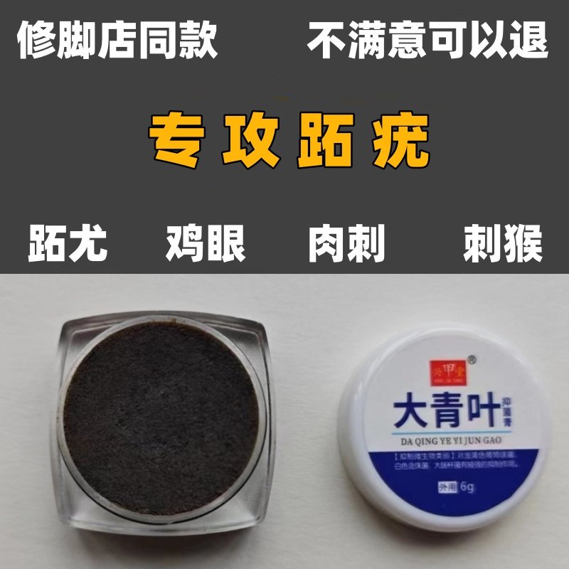 跖疣专用膏根病毒疣连根拔手足部脚底趾疣肉刺刺猴去除神器鸡眼药,医疗器械,保健理疗,淘宝优惠券,粉丝福利购,淘宝优惠卷