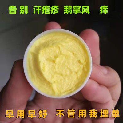 手上起小水泡抑菌汗泡疱止痒中药鹅掌风真菌感染手气湿痒疹专用膏