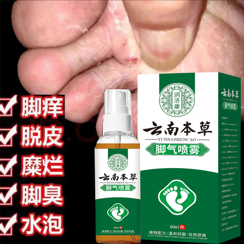 脚气狼毒喷剂脚汗真菌感染脚臭脚痒止痒脱皮烂脚丫水泡脚气克星