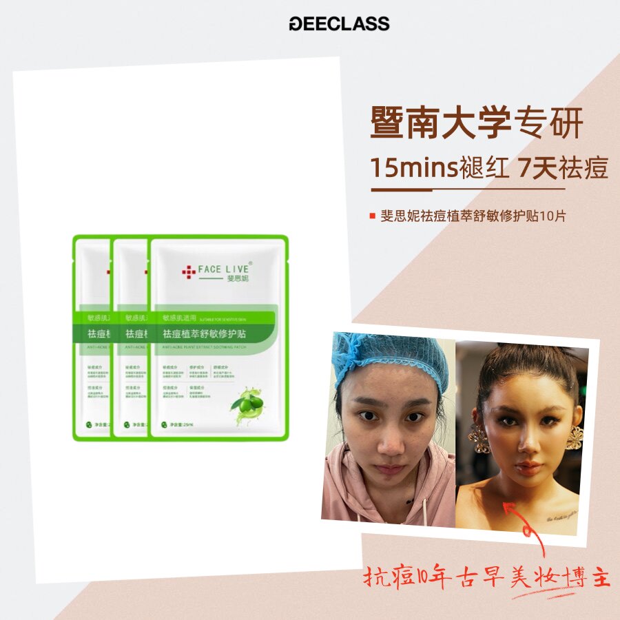 老季甄选｜斐思妮植萃祛痘面膜舒贴片面膜