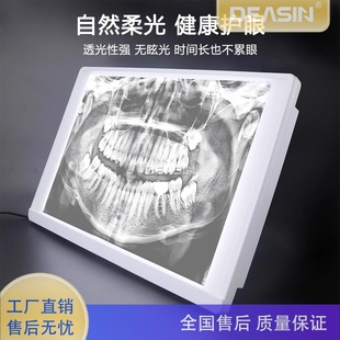 牙科口腔拍照观光灯稳易装 口内摄影LED灯护眼透光好高聚光性