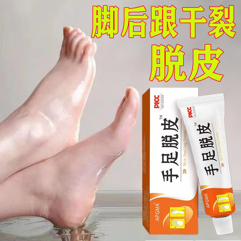 烂脚丫脱皮脚痒手足脱皮膏手脚干裂脱皮滋润皮肤脚脱皮佳用药