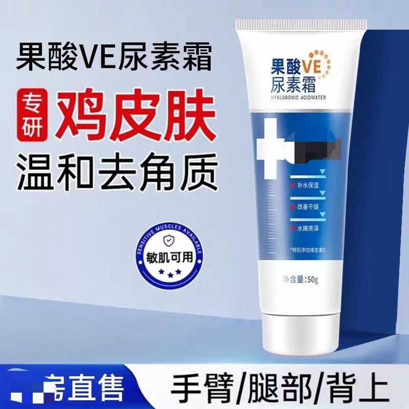 祛鸡皮肤有效的方法果酸ve尿素霜身体乳疙瘩鸡皮维生维乳霜男女