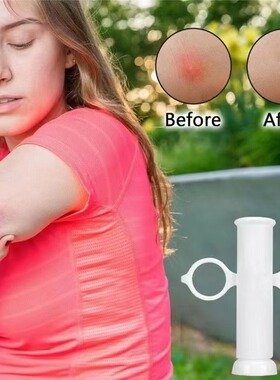 Bug bite thing物理蚊子虫咬止痒仪小工具蚊虫叮咬止痒神器拔除器