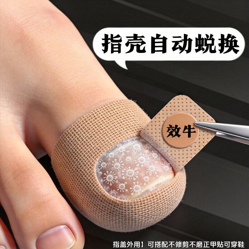 【国药热销】复购率%99 净甲贴正品专用贴植物萃取脚趾手指甲专用