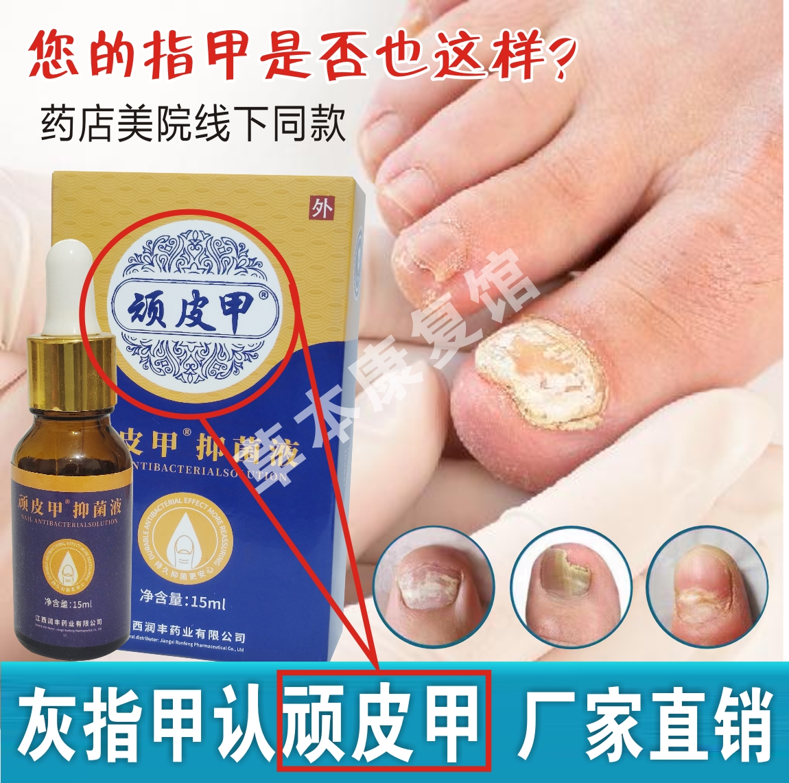 顽皮甲亮甲灰指甲抑菌液官方正品