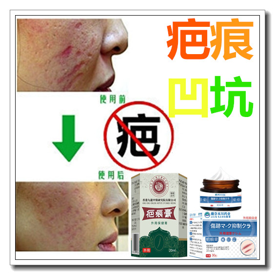 淡化沉着色素修复膏去除沉淀回流手术烧烫伤疤祛脸部痘印色斑疤痕