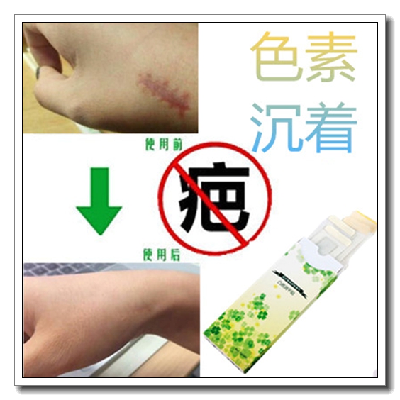 祛除暗沉红印面霜去黑色素沉积色素印痕沉着回流淡化抓伤疤痕黑印