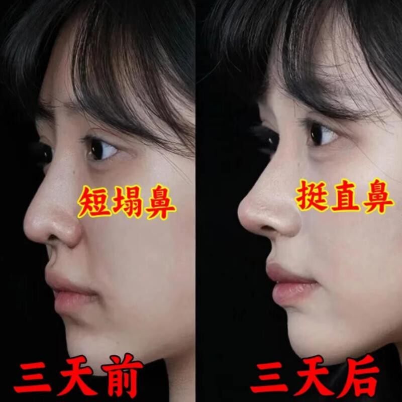 【爆款推荐】香港明星网红都在用的美鼻神器3D硬鼻翼短翘鼻高挺鼻