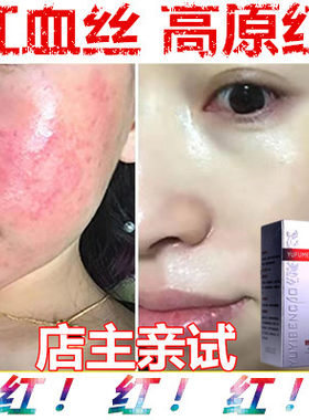保湿祛红血丝补水原液淡化正品修复增厚角质层薄男女褪红护肤产品