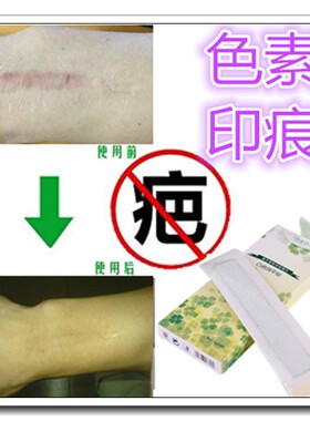 去烧除伤疤巴痕增生的药祛黑素脸部黑色素遮盖增生疤痕凸起疙瘩贴