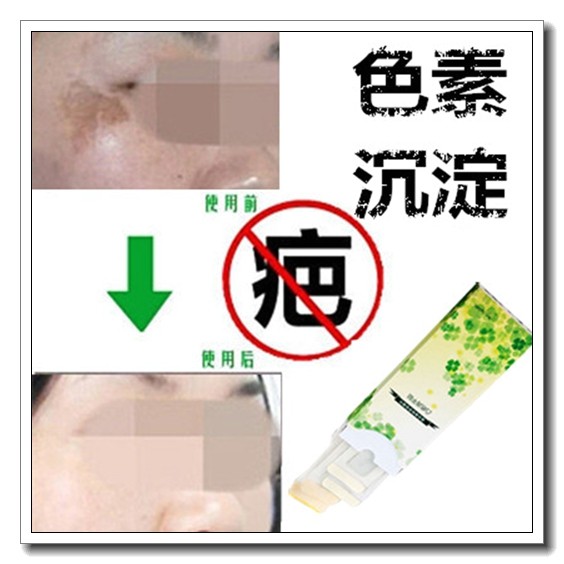 淡化去暗沉红印痘疤痕印修护抓伤色素印痕祛除黑色素沉淀回流产品,美容护肤/美体/精油,复方精油,淘宝优惠券,粉丝福利购,淘宝优惠卷
