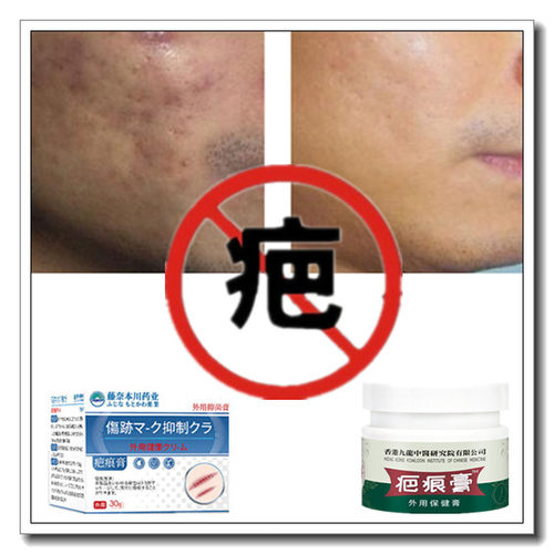祛增生修复疙瘩性凸疤缝针剖宫产伤疤痕印纹身手术抓伤黑色素回流