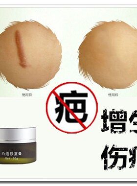 去除手术缝针印烧烫伤疤痕灵修复脸部凹凸起软化增生性正品的药膏