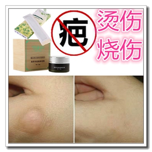 防止烫烧伤疤痕增生贴敷料止痛膏药促黑色素手术伤痕修复伤口消疤