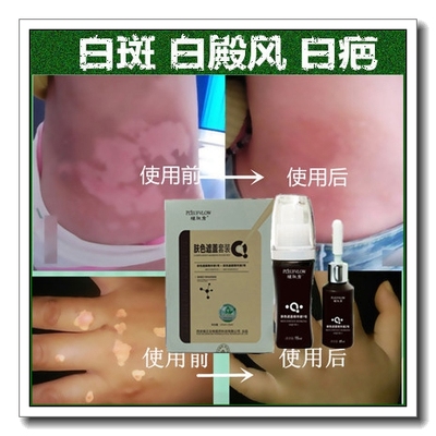 促黑色素白斑净白殿风遮盖白色白印药膏持久外用正品防水型遮瑕霜