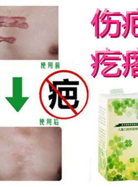 修复增生性突疤祛疙瘩消除去手术产后开刀伤疤痕印淡化烟疤药产品