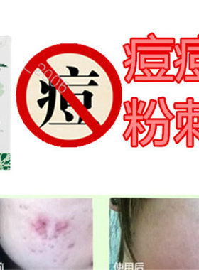 去后背部痤疮膏祛除男女胸前封闭合性痘痘液消除酒渣鼻黑头痘痕印