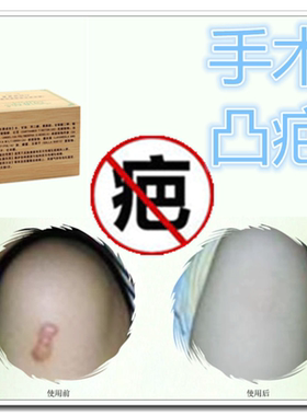 去除手术缝针伤疤痕灵淡痣淡化黑色素正品的药膏修复脸部抓伤排毒