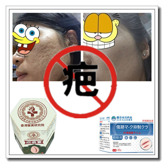 灵疙瘩修复增生性凸疤手术剖腹产伤疤痕印纹身缝针抓伤色素沉着疤