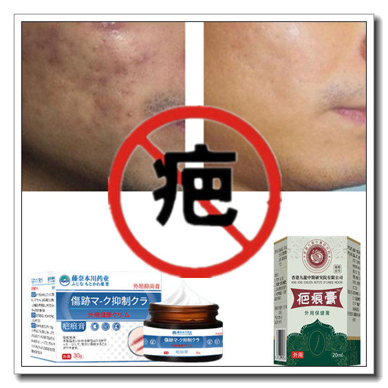 修复增生性体质软化凸疙瘩去除手术后伤疤痕印灵祛烟疤沉着色素药