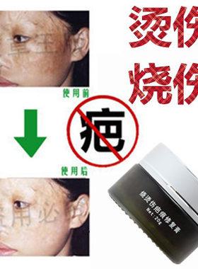 修复去增生性疙瘩烟烫烧伤巴疤痕印软膏药产品消祛黑色素沉着正品