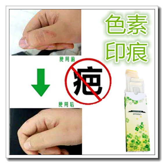 疤痕印正品去除黑色素沉淀去手术复方精油