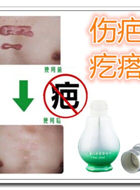 祛脸部损伤去凸起疤痕灵烫伤增生性疙瘩除巴痕修复膏进口药芦荟胶