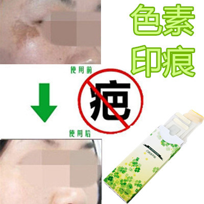 祛除男女士暗沉红印精华阻止黑色素沉淀回流淡化抓痕印褪黑疤印贴