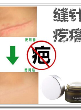 去脸部伤疤痕停的药祛巴印淡化黑色素沉淀正品舒疤宁平面膜修复膏