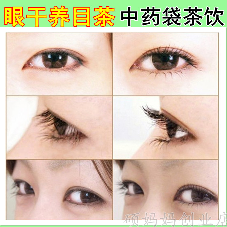 缓解眼疲劳 眼干干眼红血丝润目茶眼睛发痒干涩护眼养 肝明目