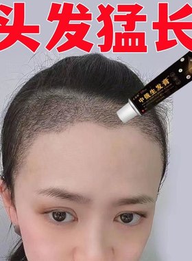 中俄生发膏放掉秃顶抑菌增发养发专用滋养快速增发密发男女通用