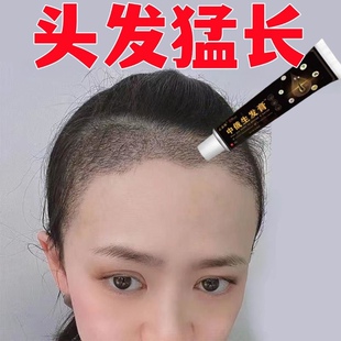 中俄生发膏放掉秃顶抑菌增发养发专用滋养快速增发密发男女通用