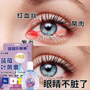 叶黄素滴眼液舒缓眼干眼疲劳止痒抗菌干涩闪亮蓝莓护理液明亮明目