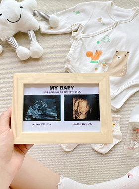 孕期B超相框宝宝四维照片木框定制ins风孕妇照个性装饰礼物纪念