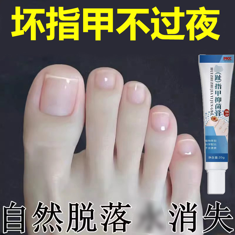 【买3送2】指甲专用草本植物严重指甲增厚抑菌草本膏 H66