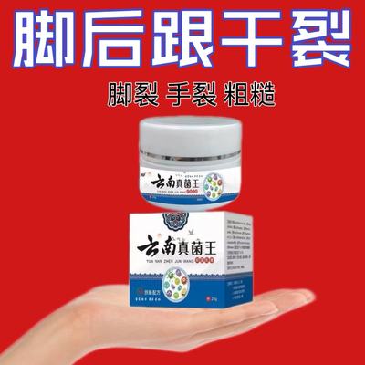 云南真菌王脚后跟手足脱皮开裂粗糙干裂抑菌膏官方旗舰店正品3xf