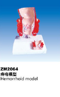 ZM2064痔疮解剖模型
