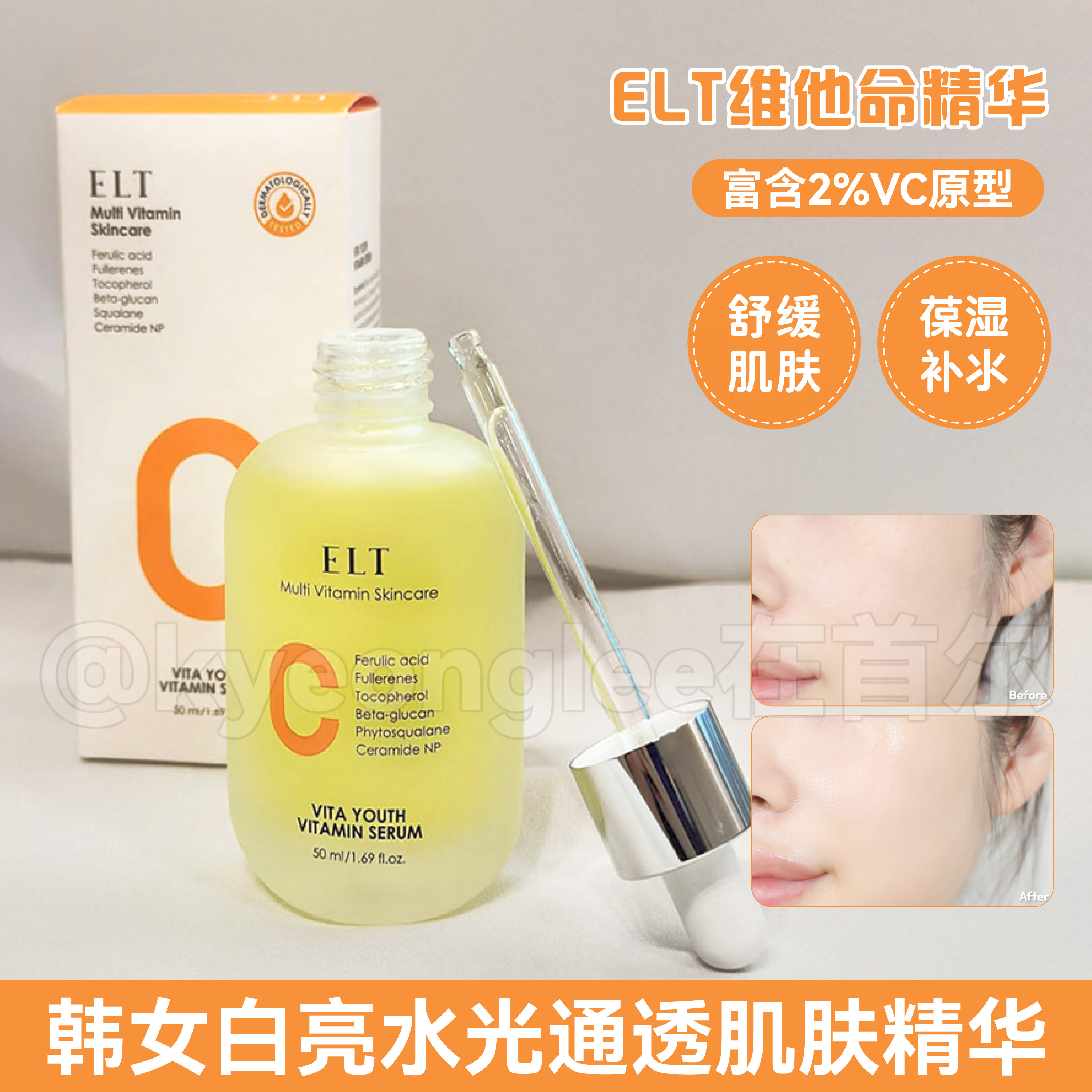 韩国ELT维他命精华VC提亮水润肌肤保湿细腻肤质酰胺修护女精华液