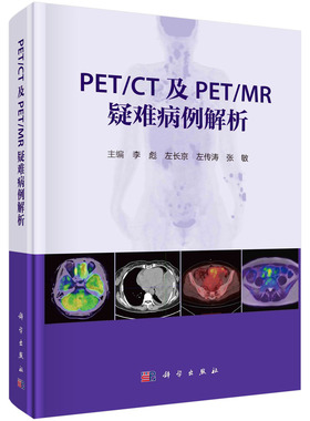 【2024新书】PETCT及PETMR疑难病例解析 李彪等疑难病影像诊断病案分析非肿瘤性病变疑难病例18F-FDG显像剂新型PET分子探针