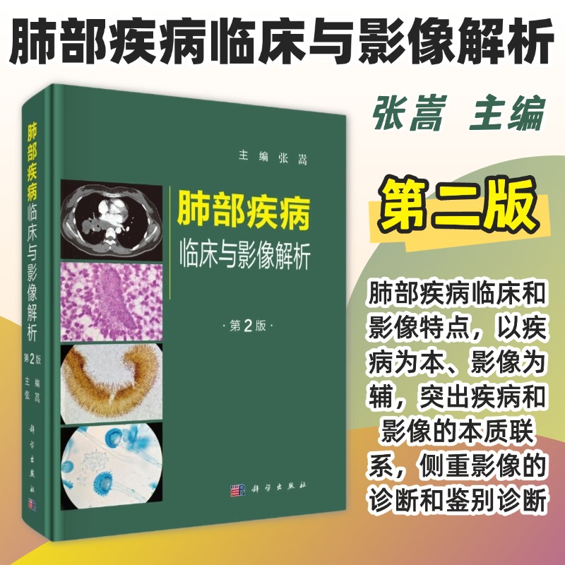 【2025新版】肺部疾病临床与影像解析第2二版张嵩肺部疾病的临床影像特点影像的诊断和鉴别诊断大量病例9787030808776科学出版社