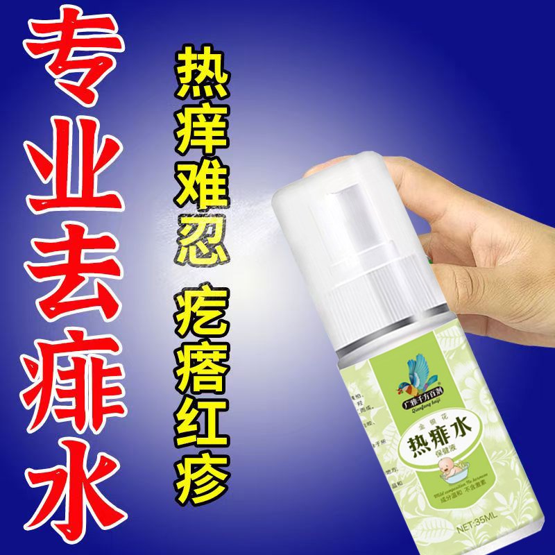 痱子止痒水成人去痱子喷雾液体祛痱膏治除热痱子水大人防菲神器药