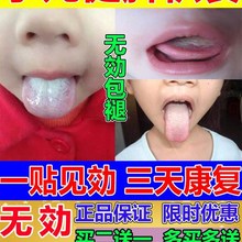小儿健脾消积食贴宝宝去内热消积食儿童口臭孩子不爱吃饭怎么办