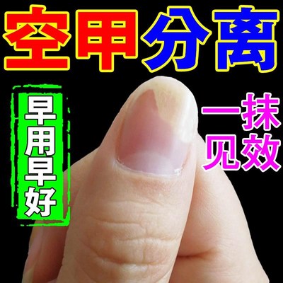 专空指甲治甲肉甲床分离空甲修复指甲生长营养液受损再生断裂竖纹