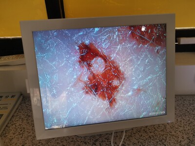 高清皮肤检测仪博丹一体机