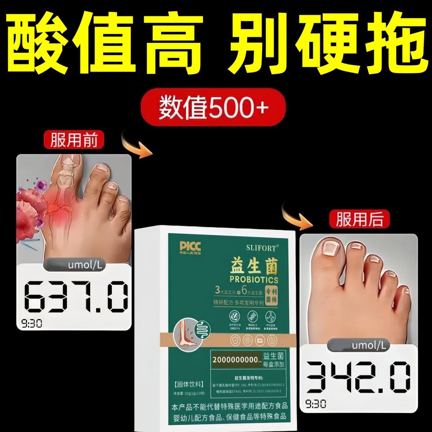 酸友高活益生菌控酸关节轻松