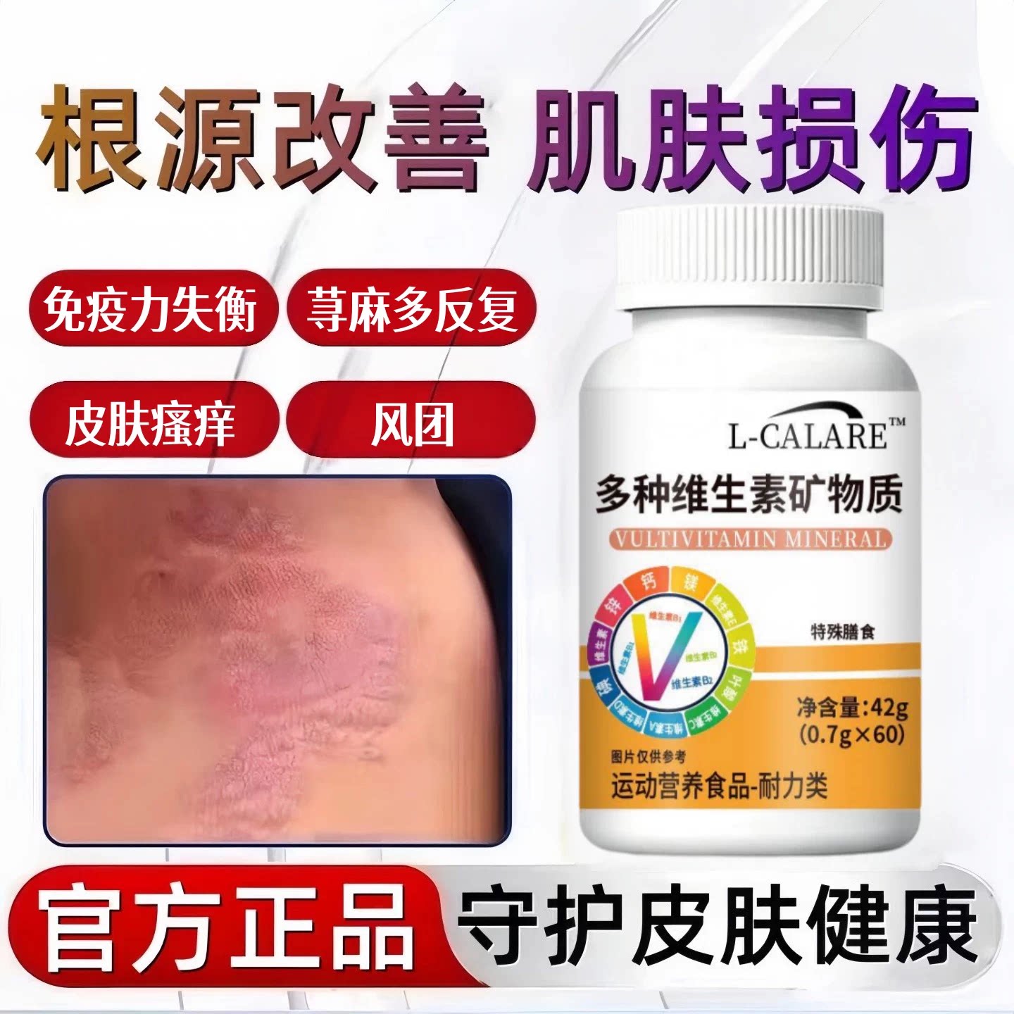 飞维复合维生素成人青少年止痒