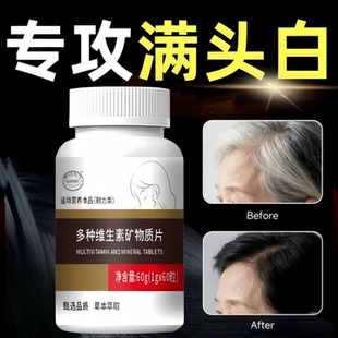 赋格方多维素维生素B乌发素内调养发白发脱发生物素黑发官方旗店